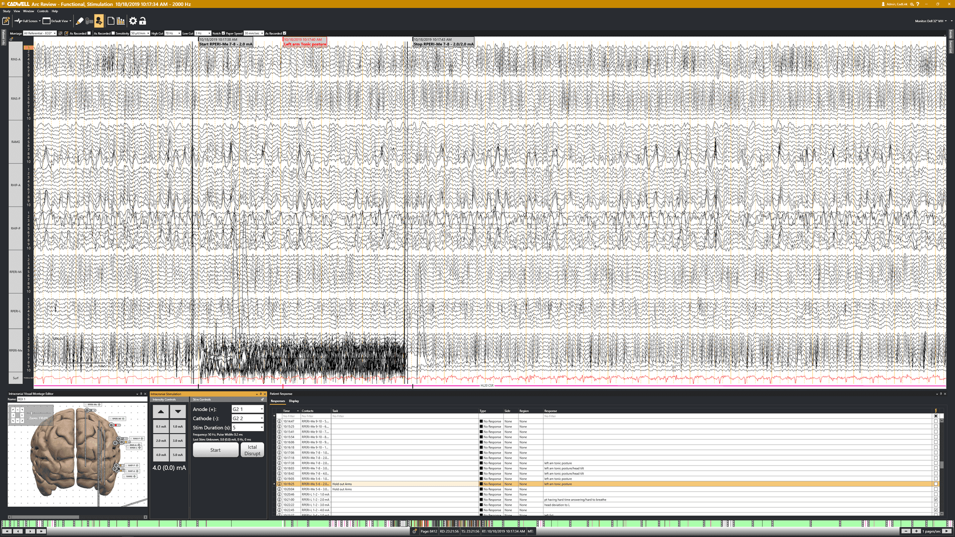 Arc EEG 소프트웨어 기능 - EEG 파형, 뇌 매핑 및 자극 매개변수 스크린샷