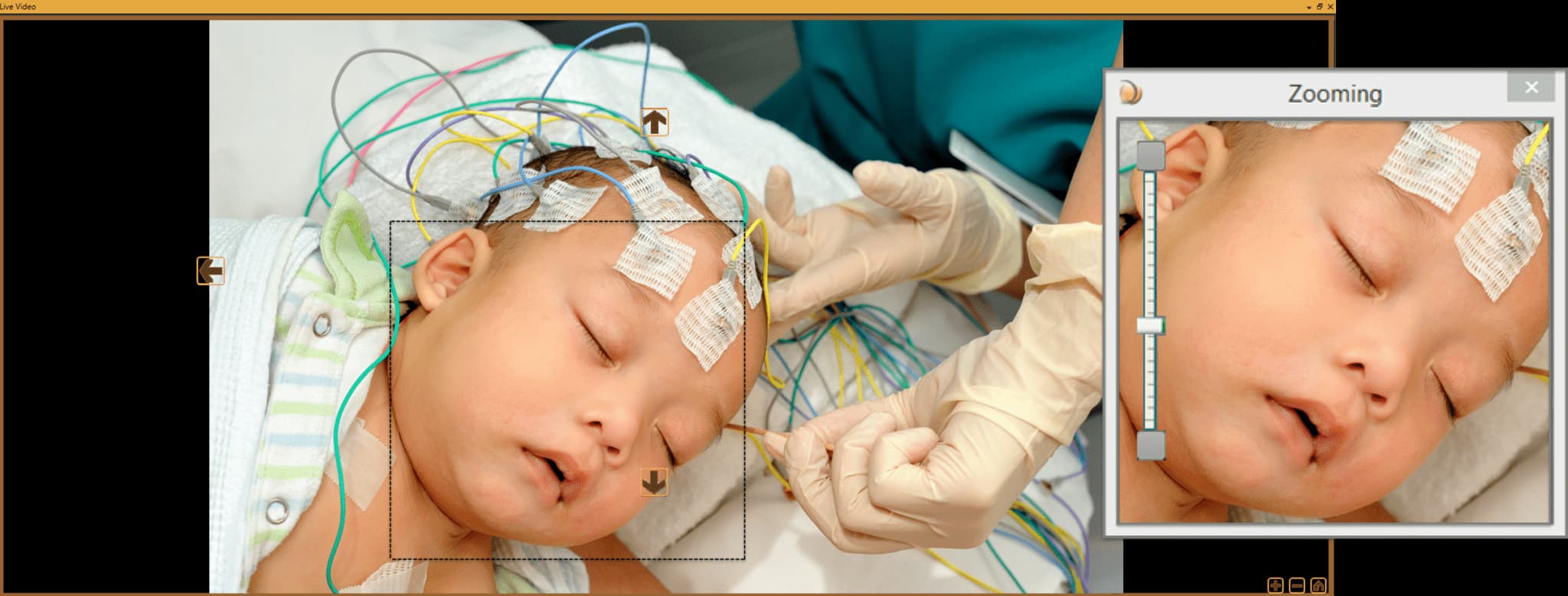 NICU 아기 모니터링