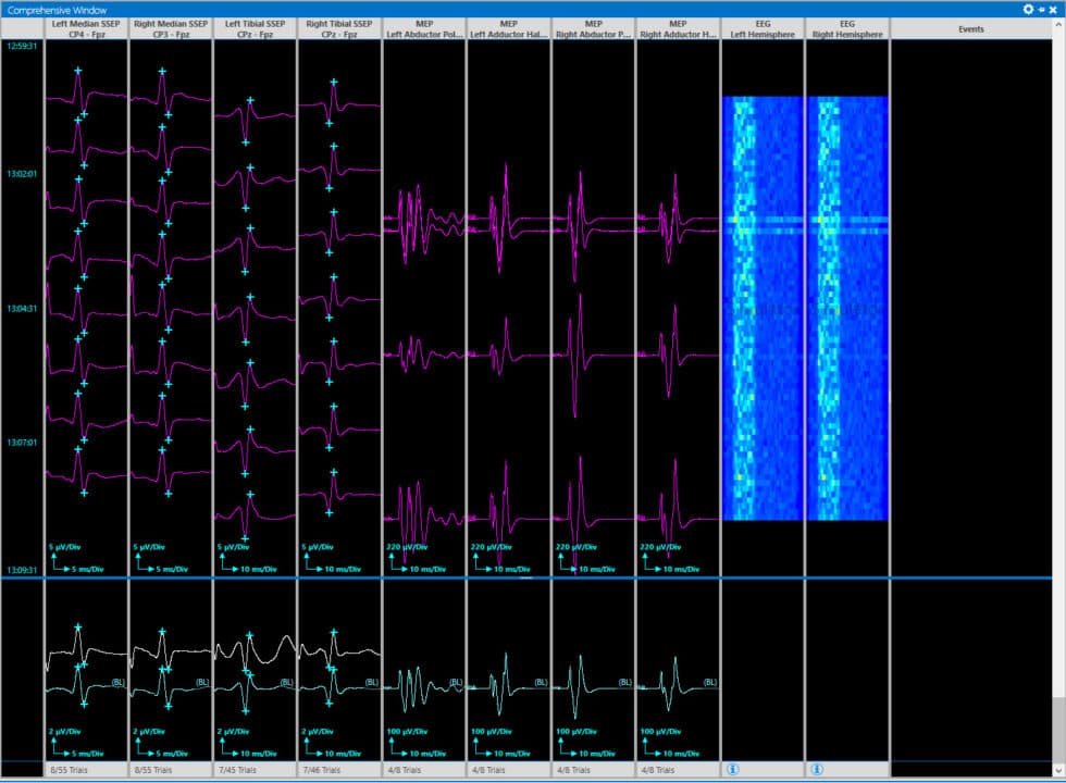원격 모니터링 및 통합 채팅