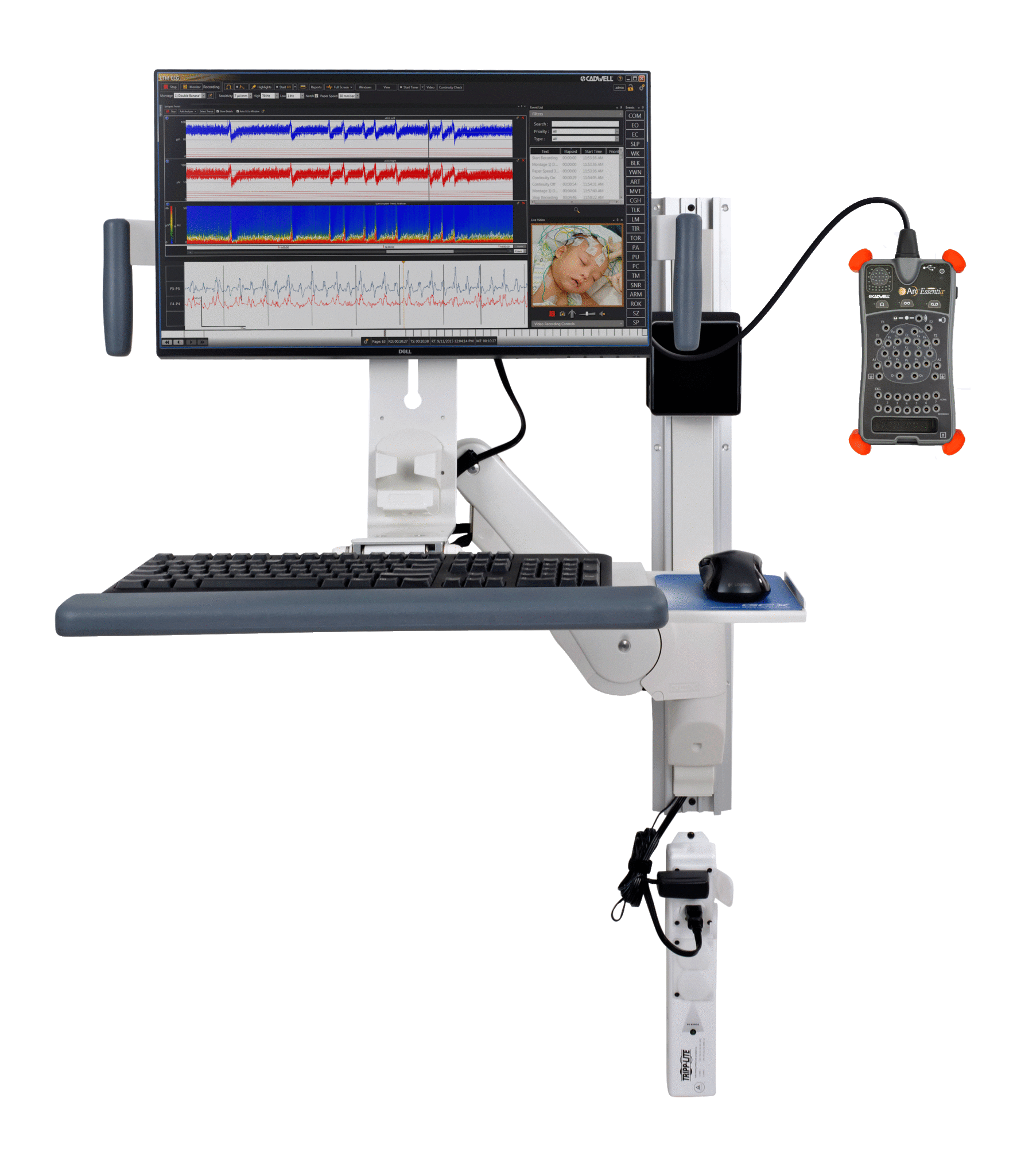 임상 및 입원 환자 사례