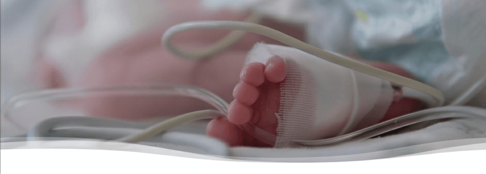 NICU EEG 모니터링