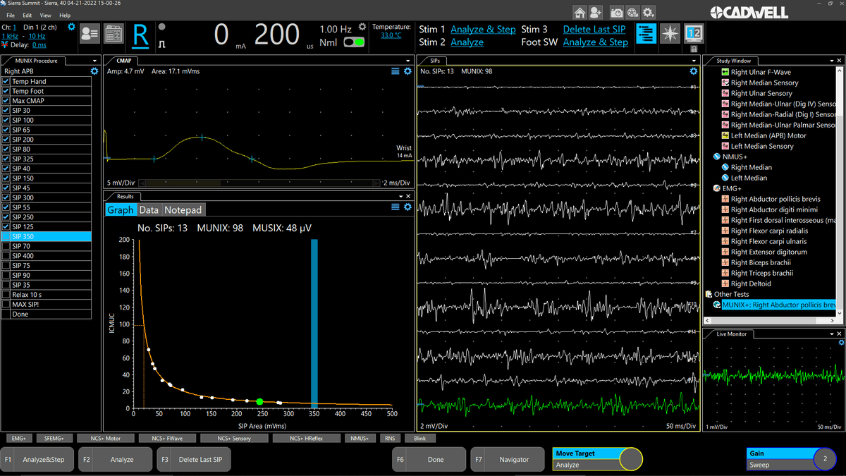 유발 전위 검사
