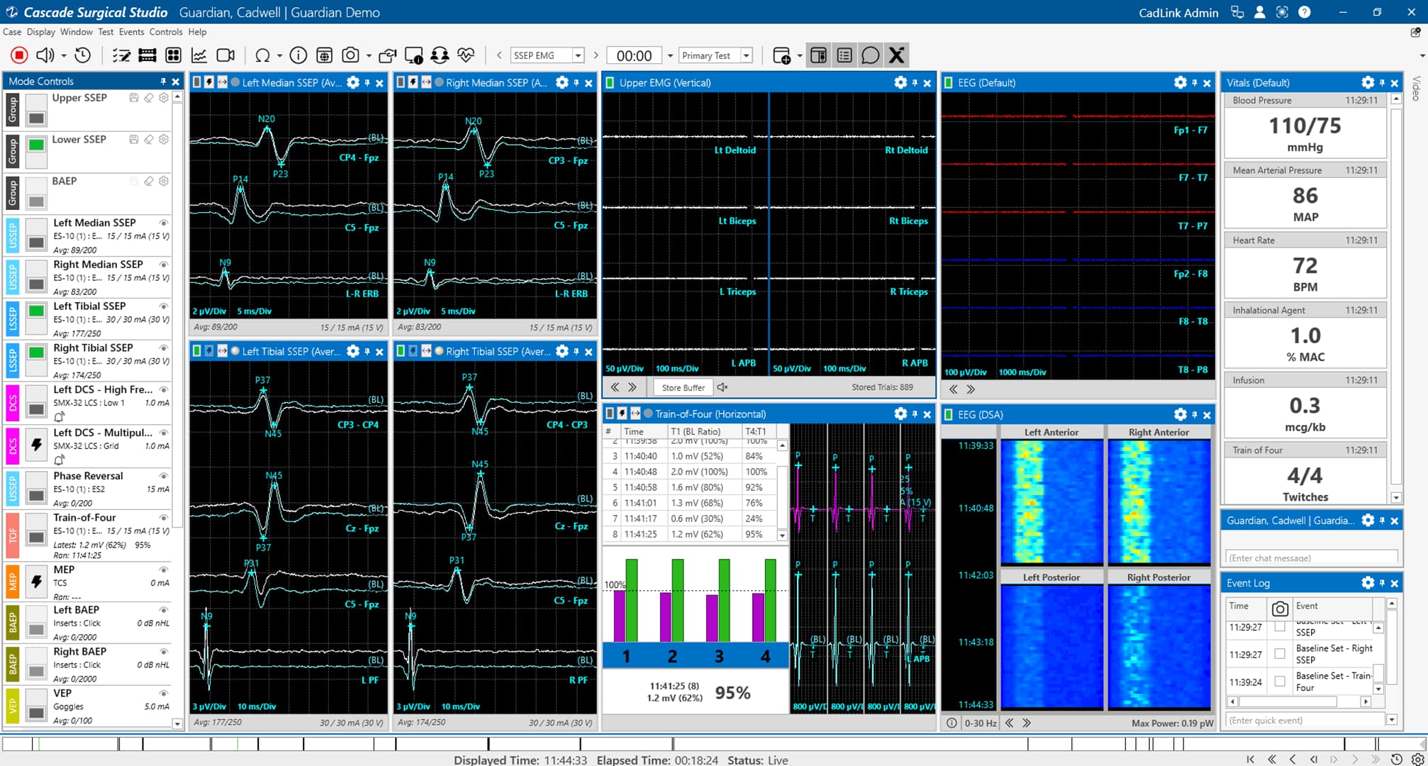 Cascade Surgical Studio 4.0 화면 확대