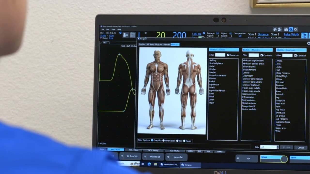 Sierra Summit과 EMG, NCS, EP, NMUS 통합 데모 영상